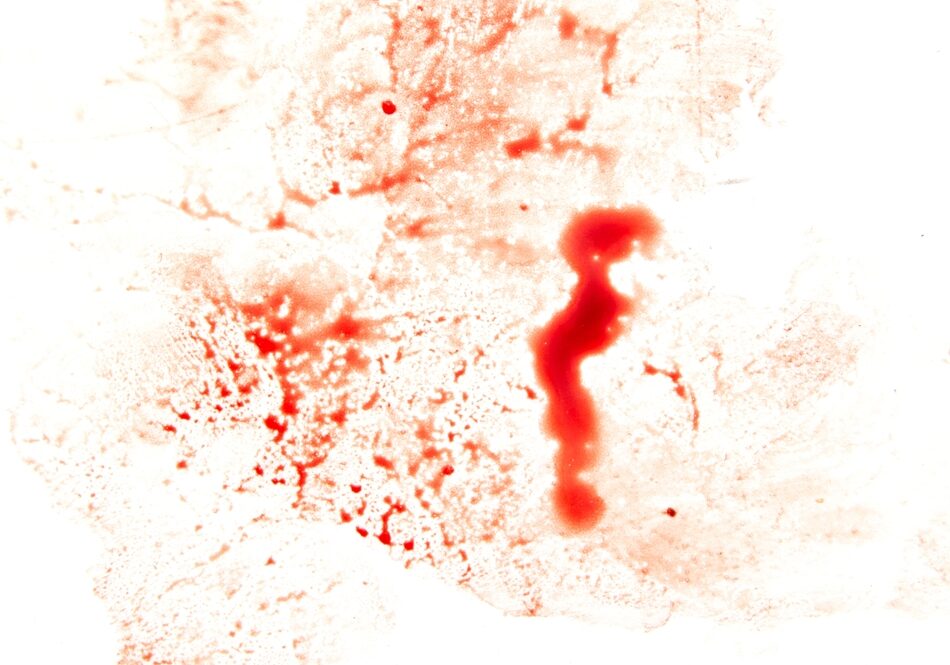 Red,Blood,On,A,White,Background.,Close-up